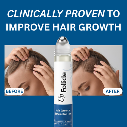UpFollicle Advanced Hair Growth Roll-On Serum