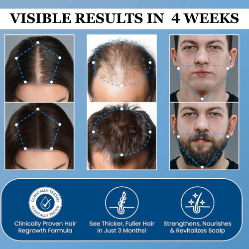 UpFollicle Advanced Hair Growth Roll-On Serum